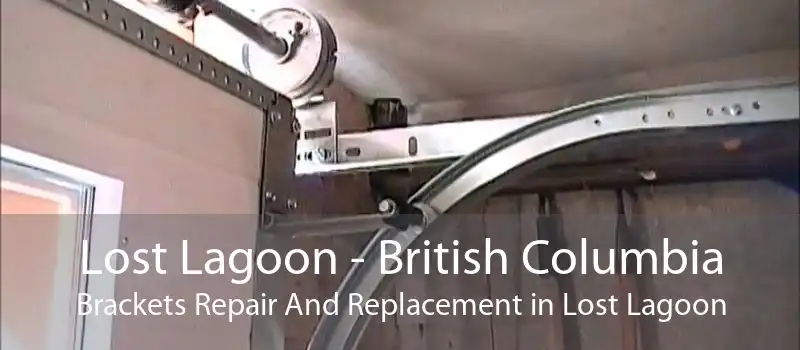 Lost Lagoon - British Columbia Brackets Repair And Replacement in Lost Lagoon
